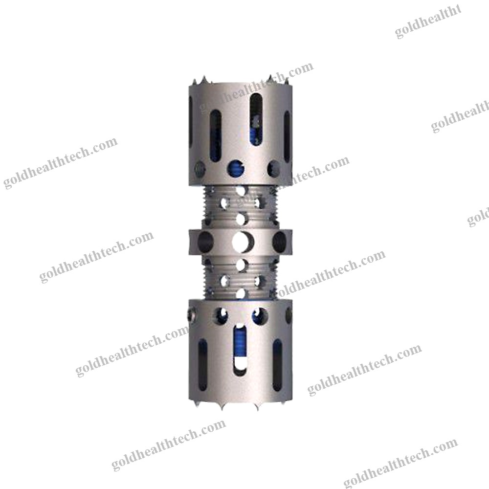 Cervical Vertebral Corpectomy Prosthesis