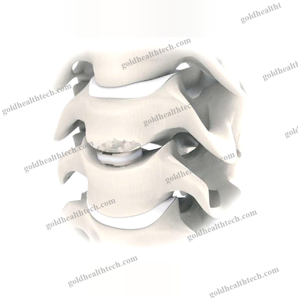 Cervical Disc Prosthesis
