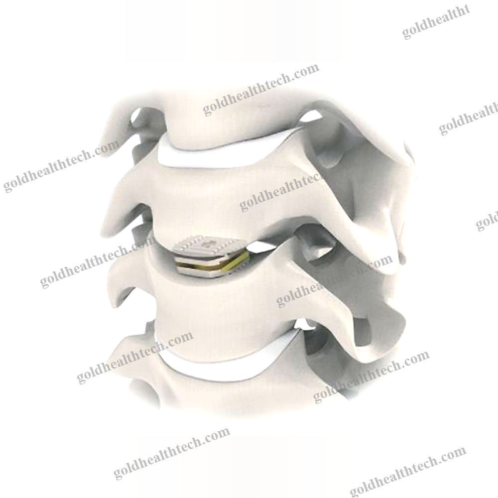 Cervical Disc Prosthesis