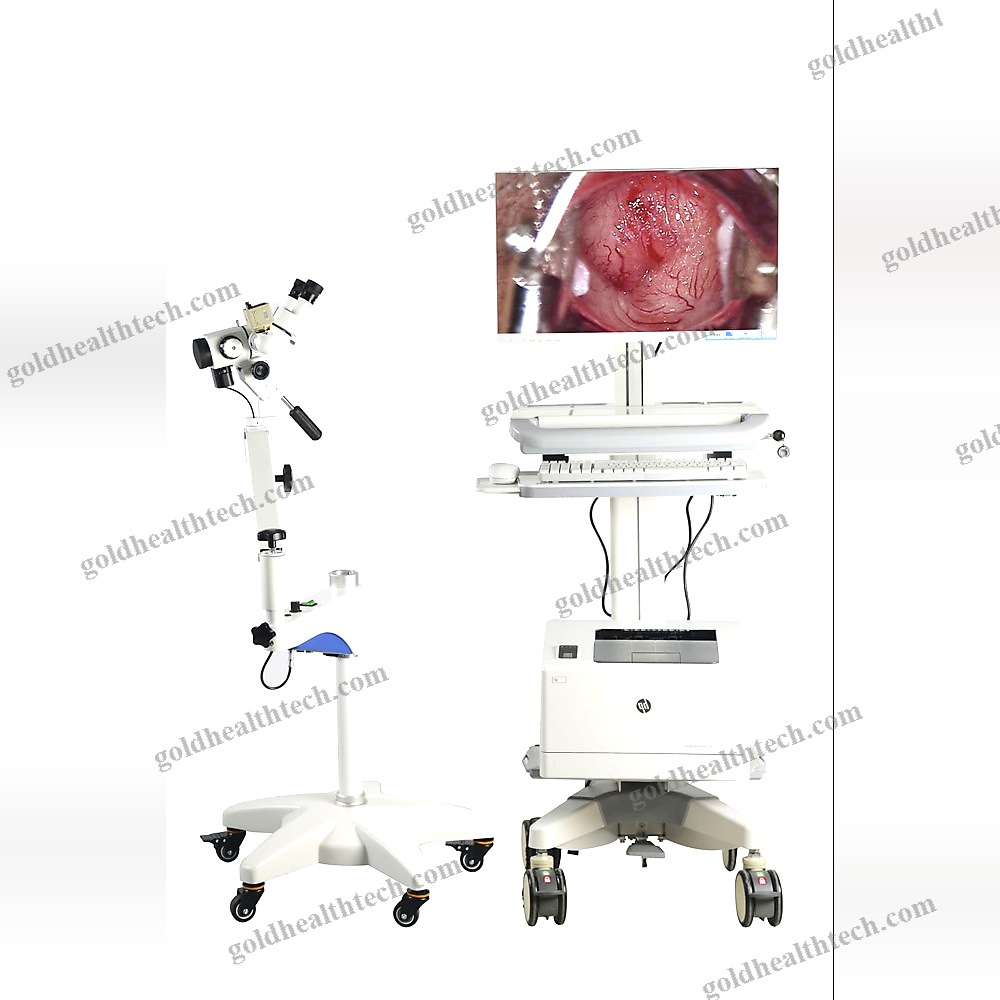 Binocular Colposcope
