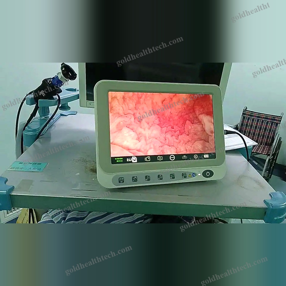 Pediatric Video Cystoscope
