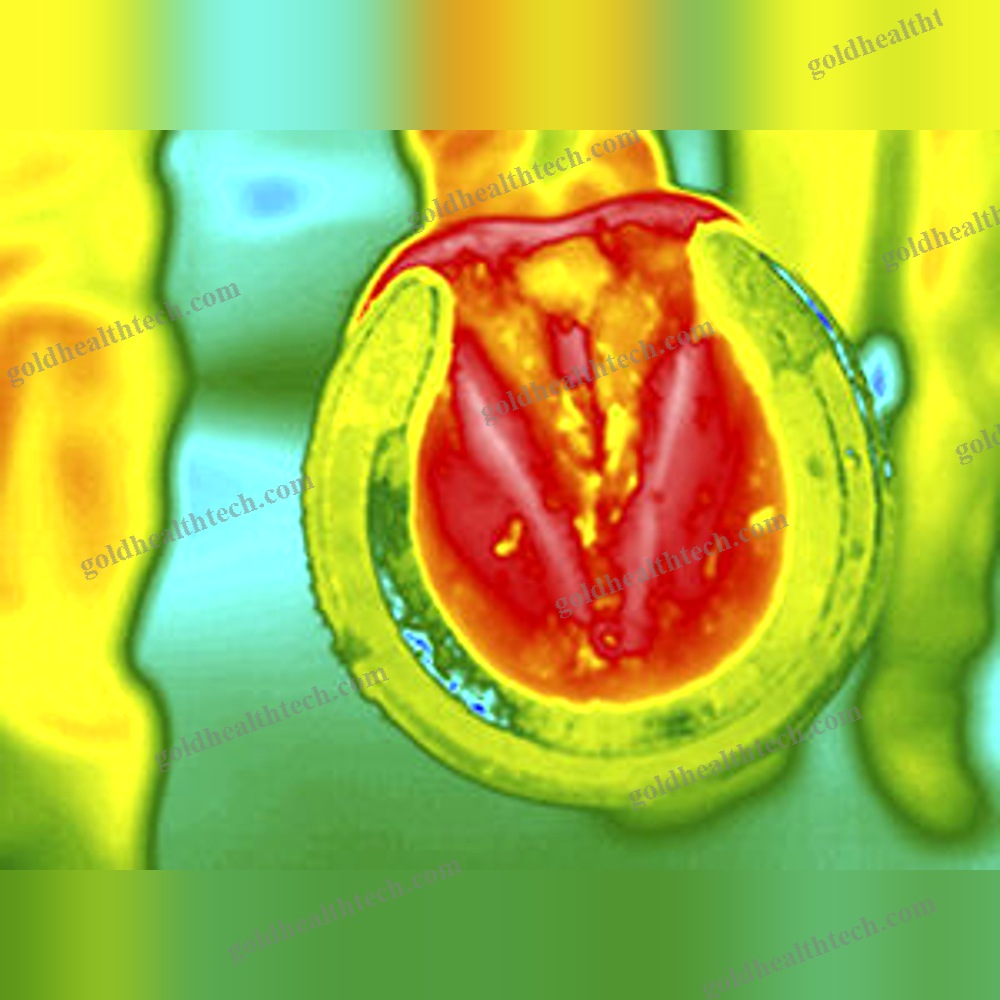 Infrared Thermograph
