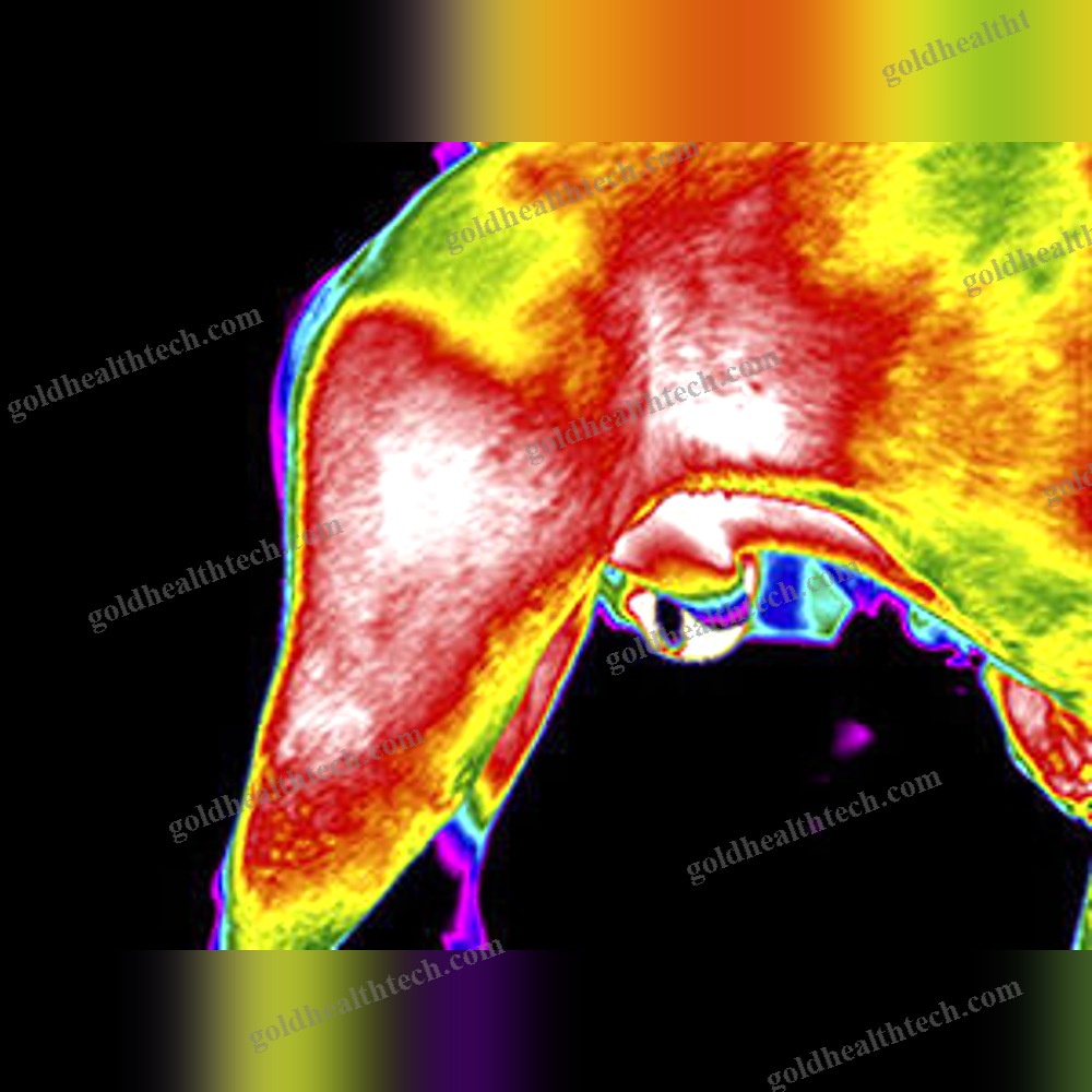 Infrared Thermograph