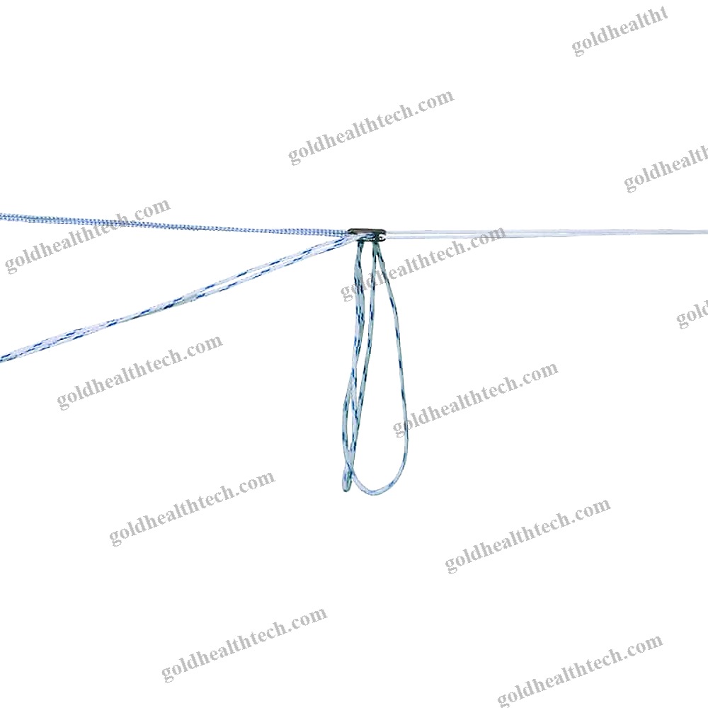 Acl Reconstruction Suture Button