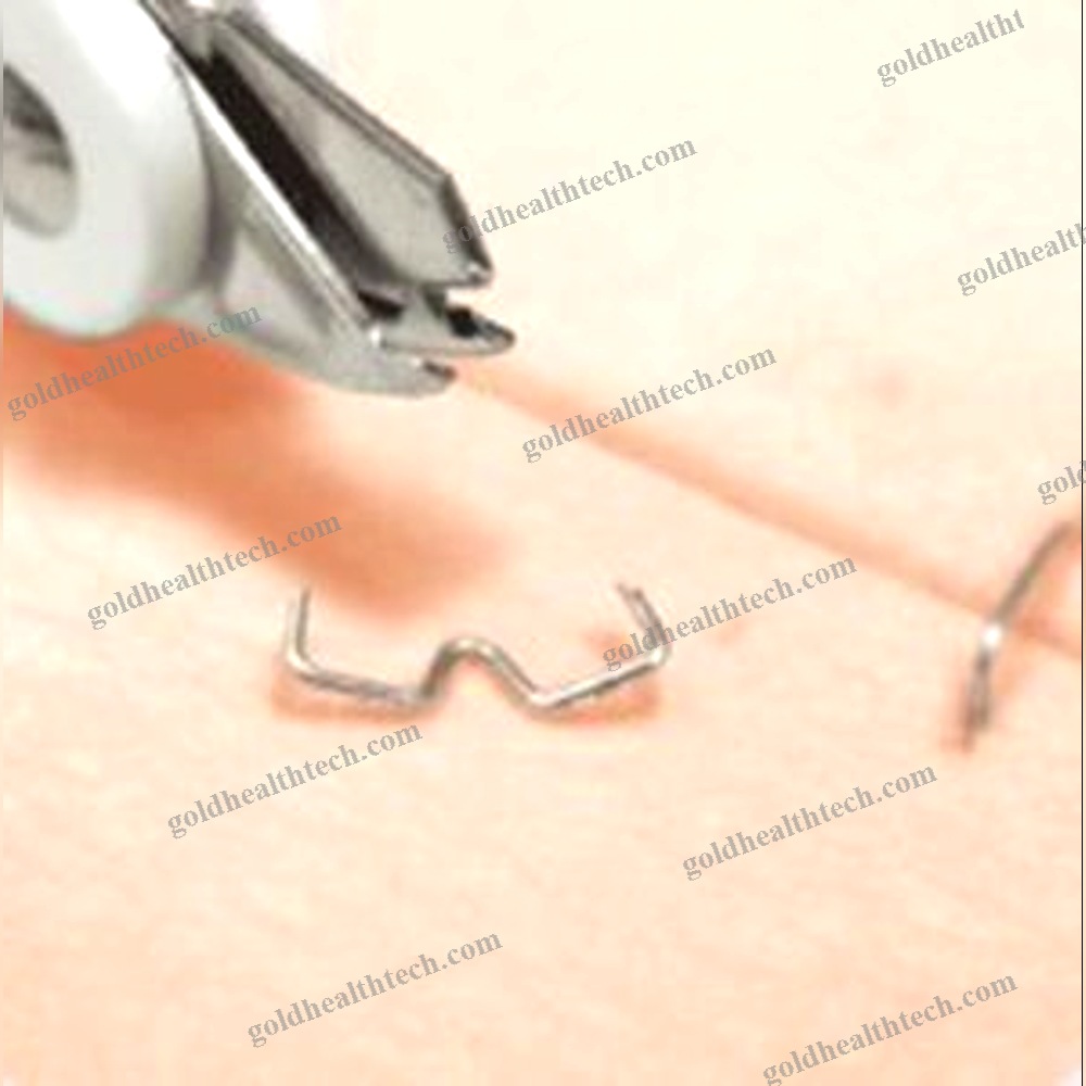 Medical Staple Remover