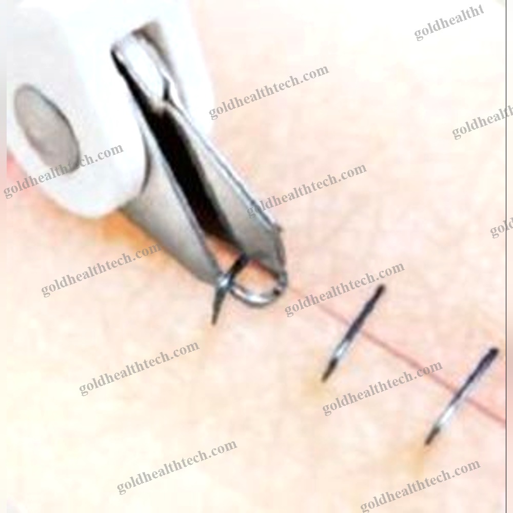 Medical Staple Remover