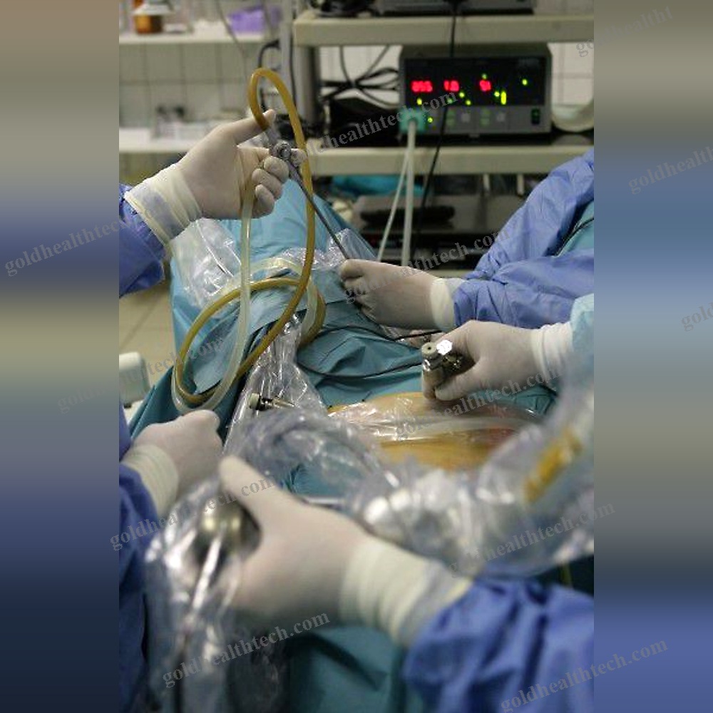 Ent Surgery Laser