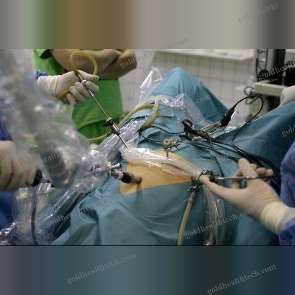 Ent Surgery Laser