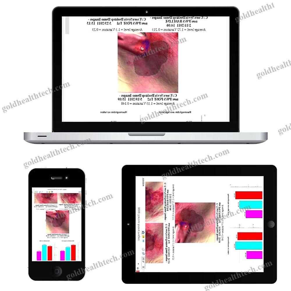 Skin Pigmentation Analysis System