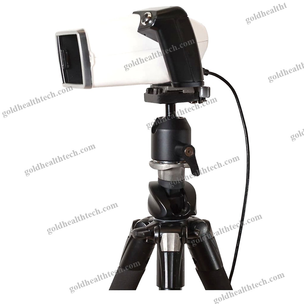 Skin Pigmentation Analysis System
