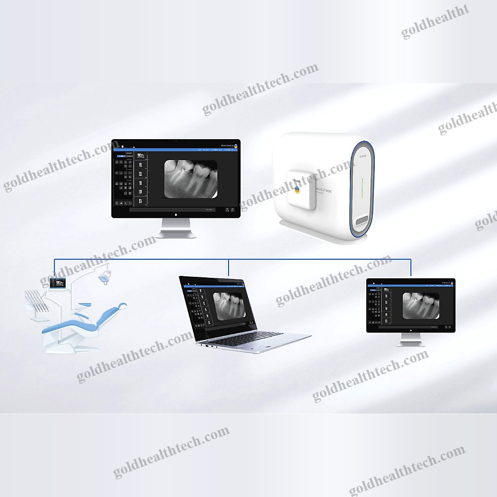 Intraoral Cr Scanner