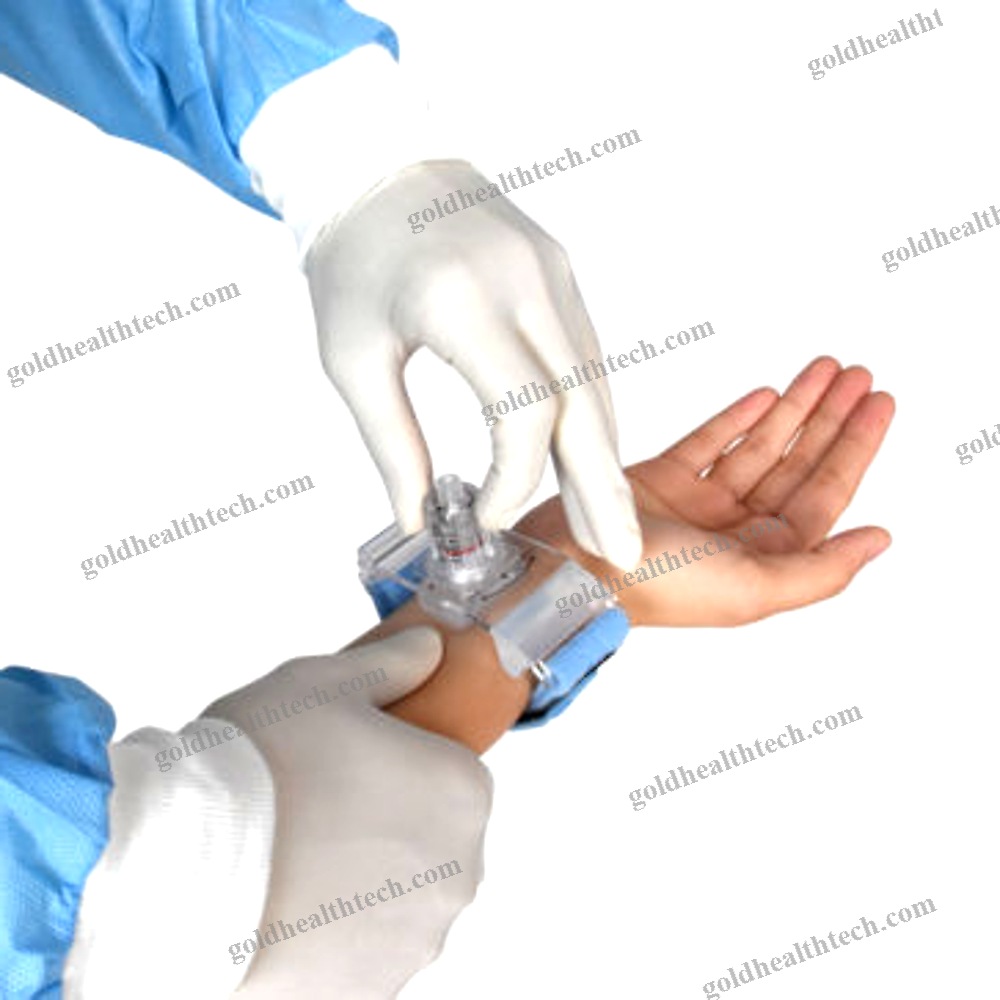 Radial Artery Compression Device
