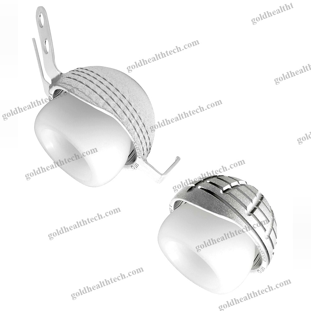 Cementless Acetabular Prosthesis