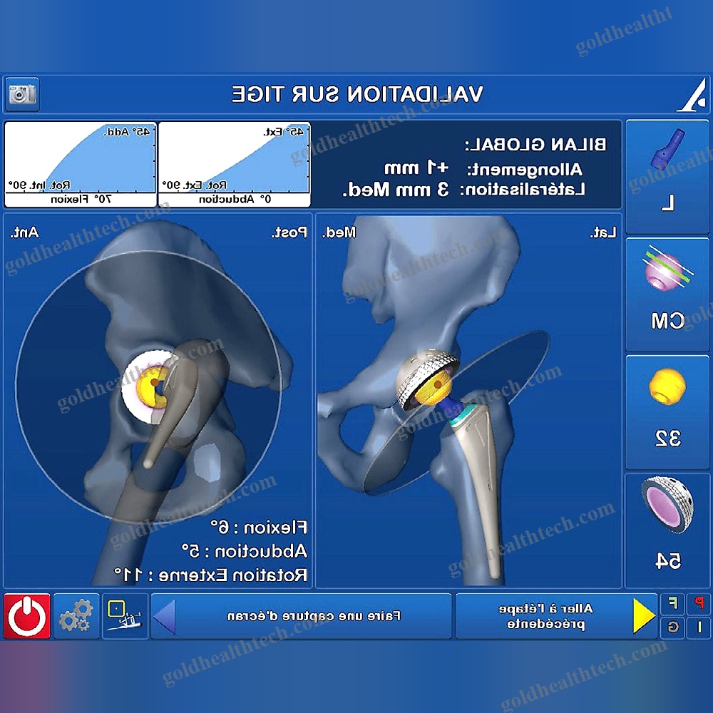 Knee Prosthesis Positioning Surgical Navigation System