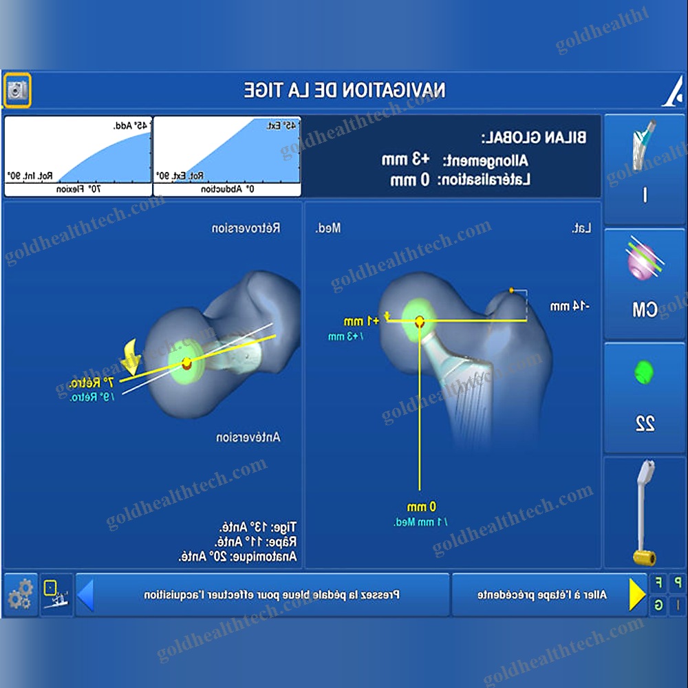 Knee Prosthesis Positioning Surgical Navigation System