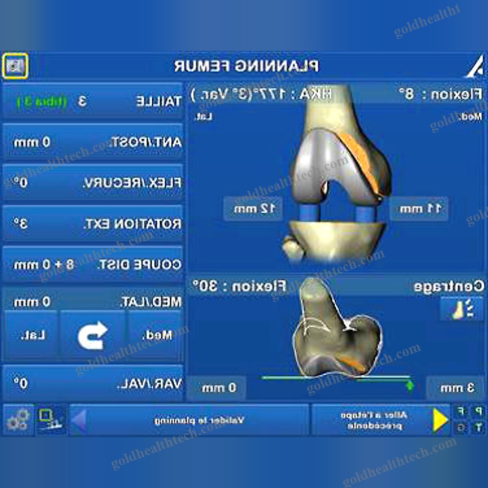 Knee Prosthesis Positioning Surgical Navigation System