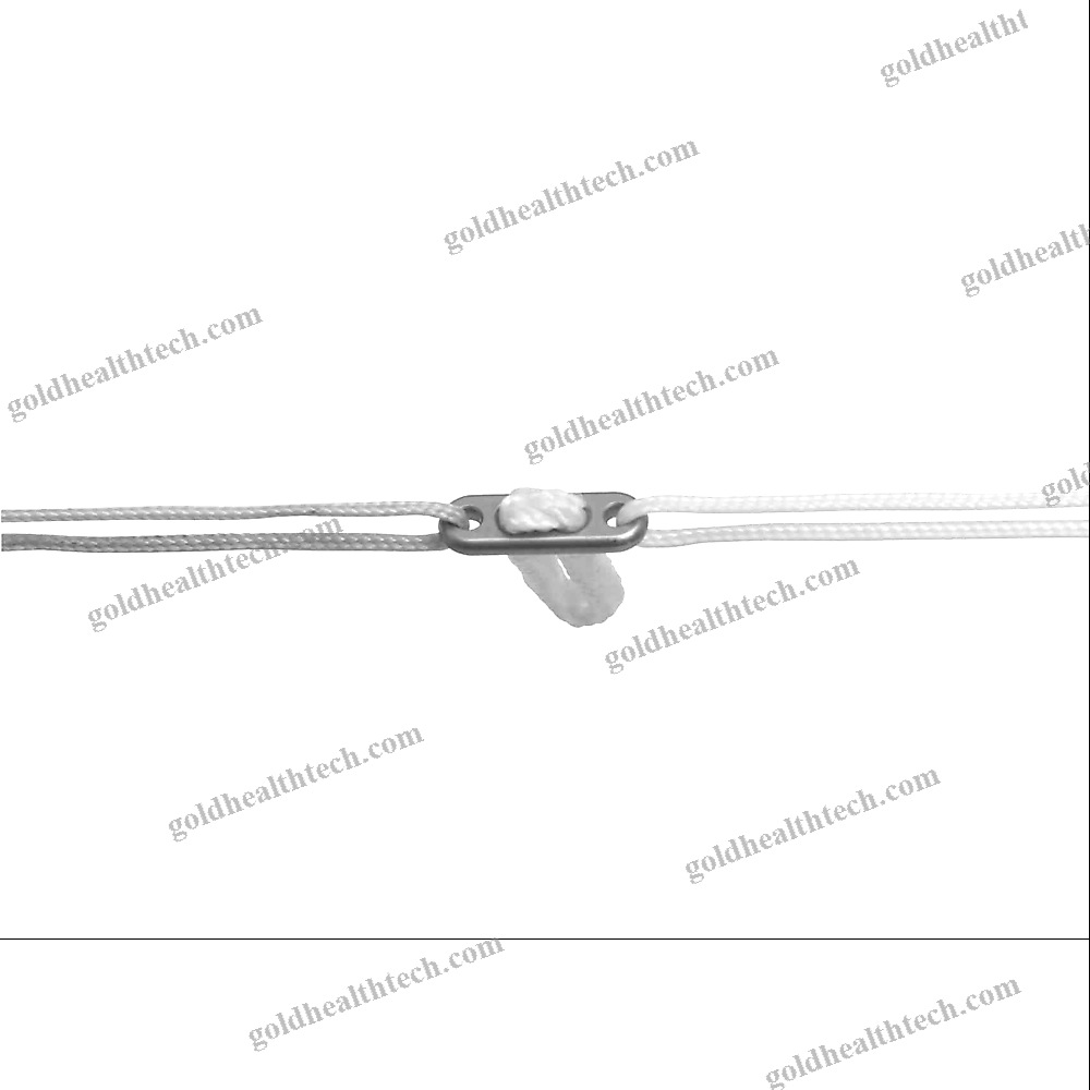 Acl Reconstruction Suture Button