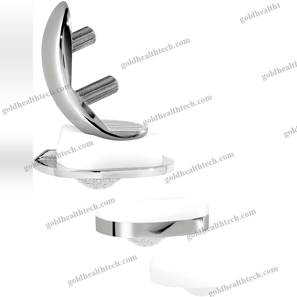Unicompartmental Knee Prosthesis