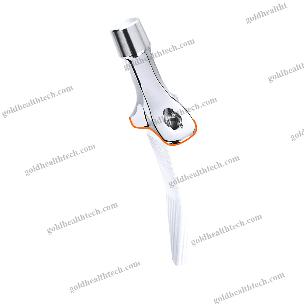 Cementless Femoral Stem