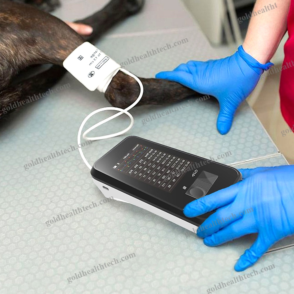Automatic Blood Pressure Monitor