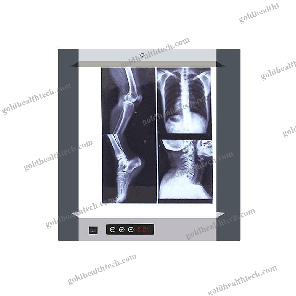 Digital X-Ray Film Viewer