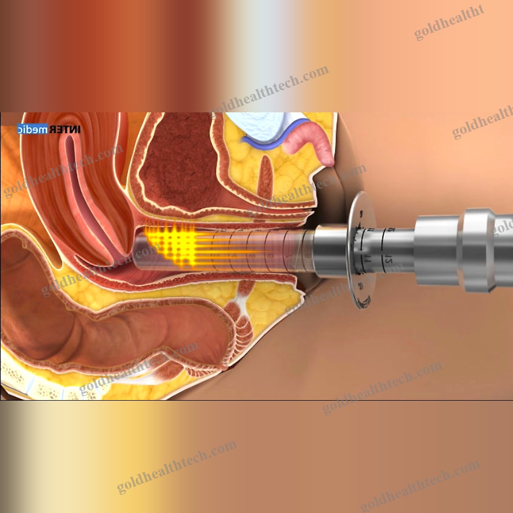 Gynecological Surgery Laser