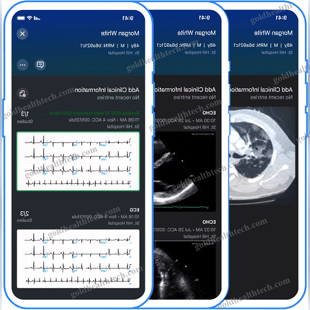 Echocardiography Mobile Application