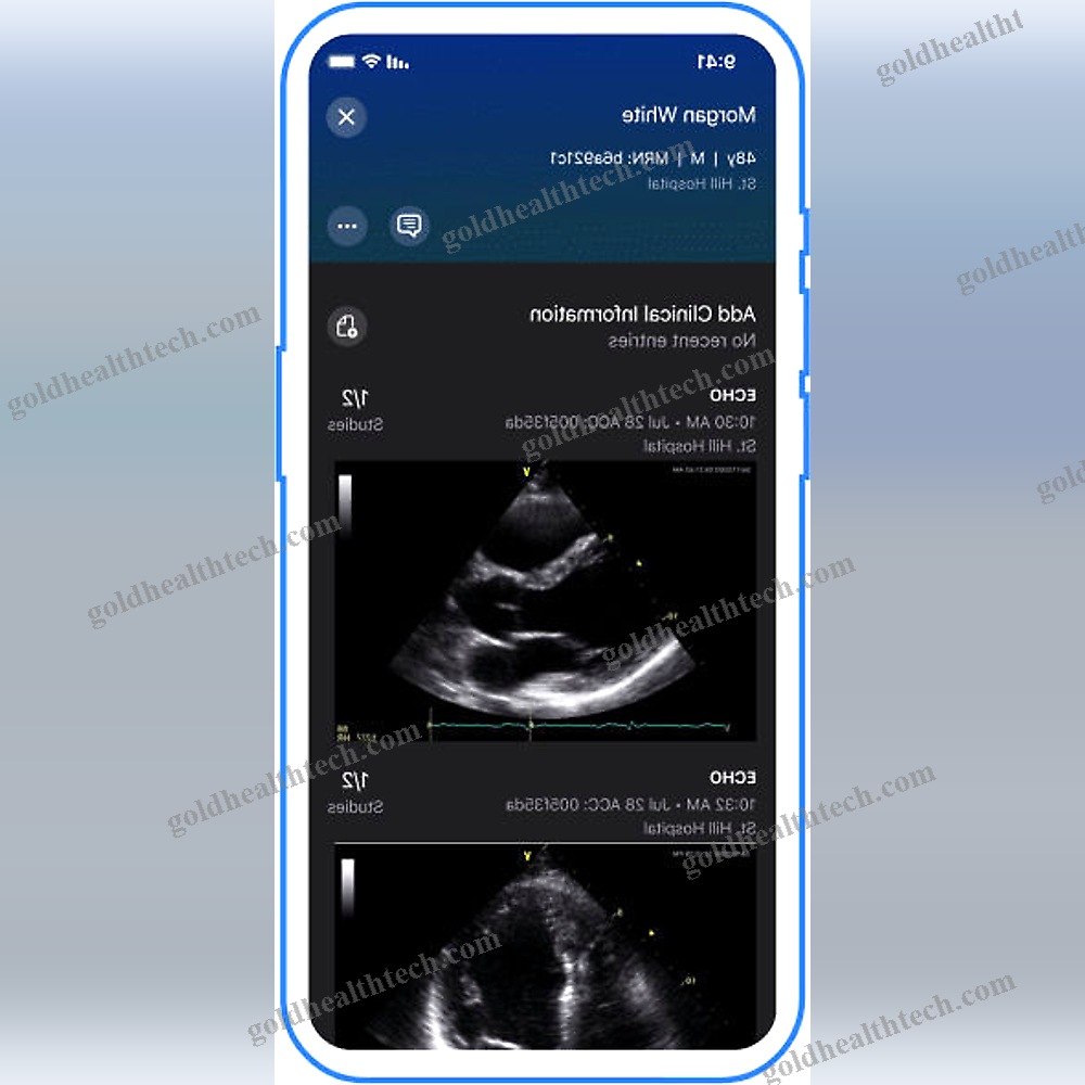 Echocardiography Mobile Application