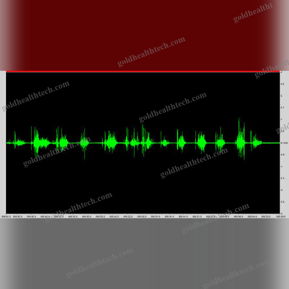 Emg Software