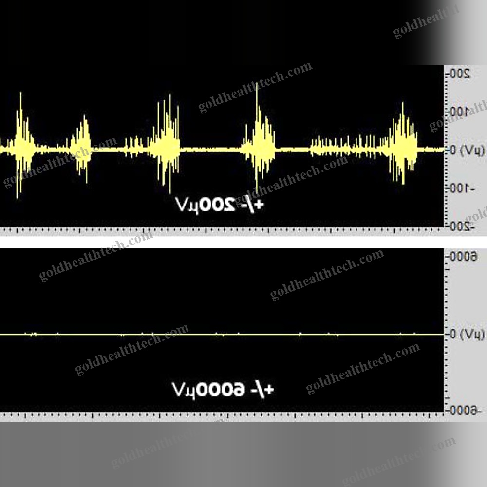 Emg Software