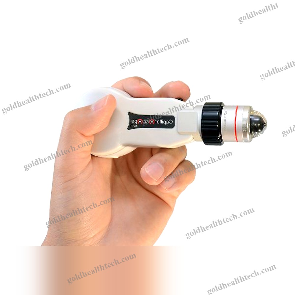 Video Capillaroscope