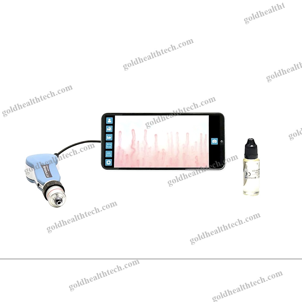 Video Capillaroscope