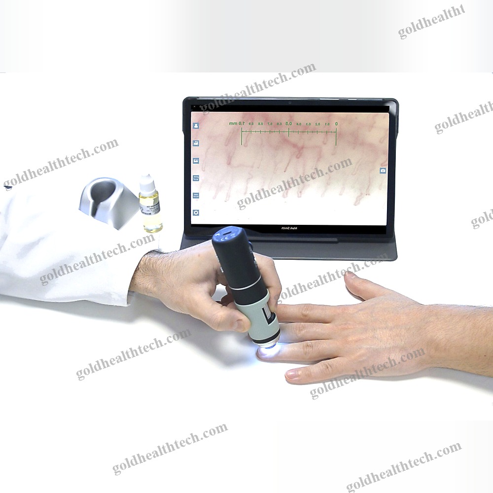 Video Capillaroscope