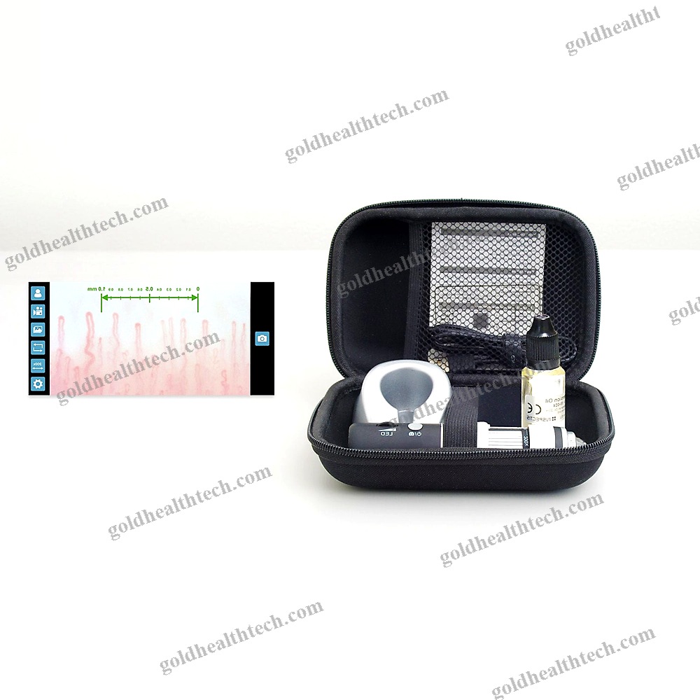 Video Capillaroscope