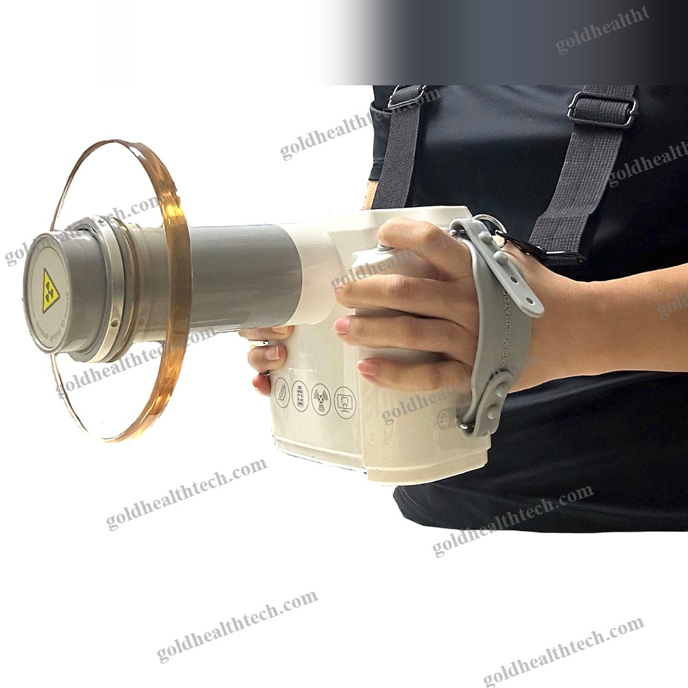 Intraoral X-Ray System