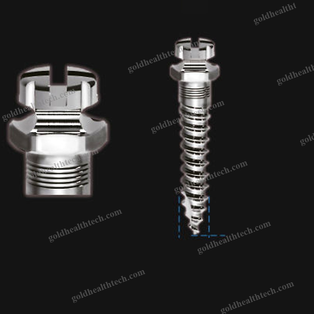 Titanium Implant Screw