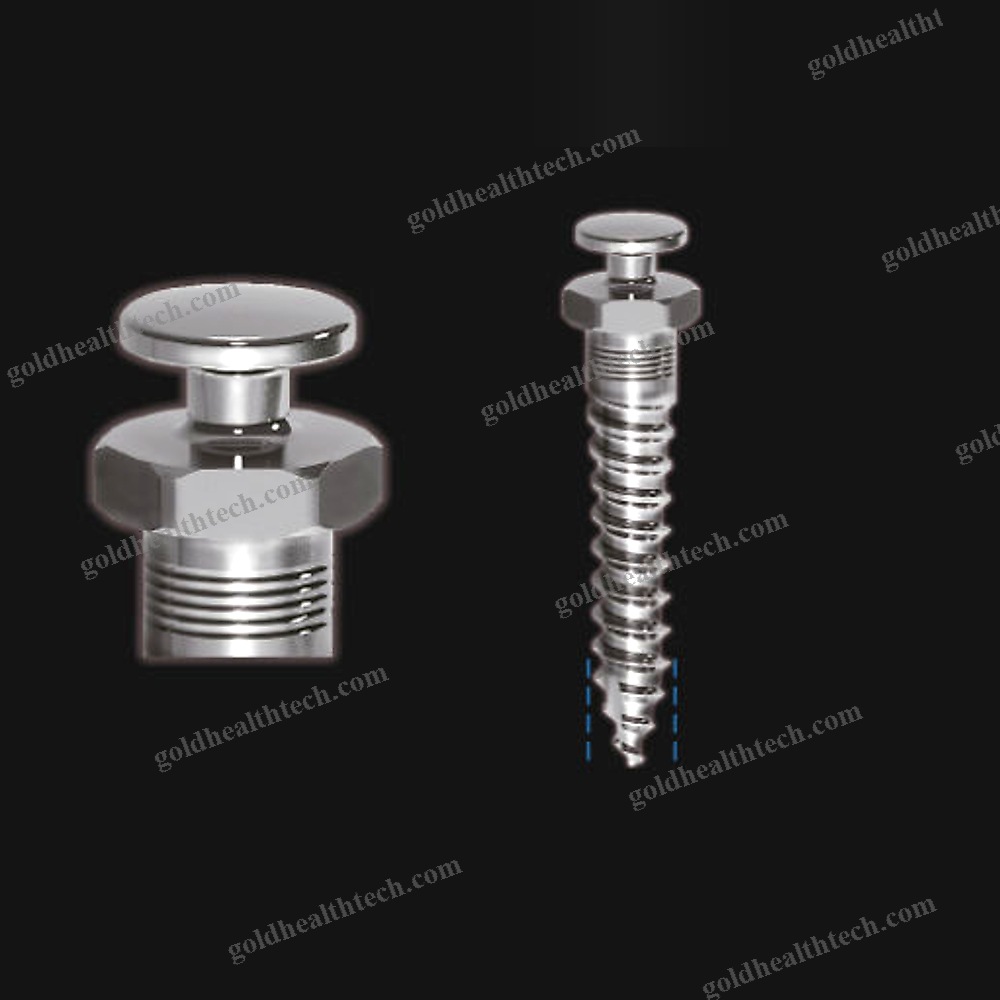 Titanium Implant Screw
