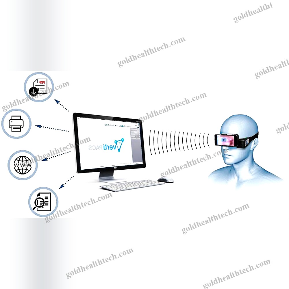 Vidéonystagmoscope