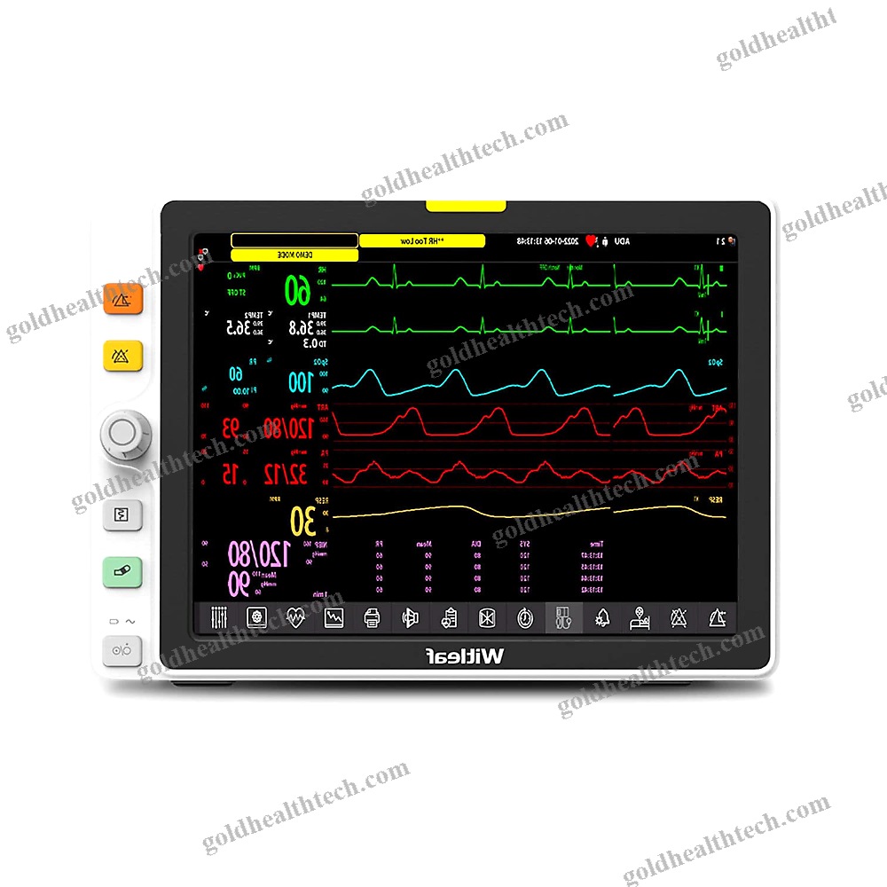 Trolley-Mounted Patient Monitor