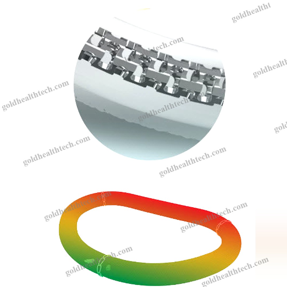 Mitral Annuloplasty Ring