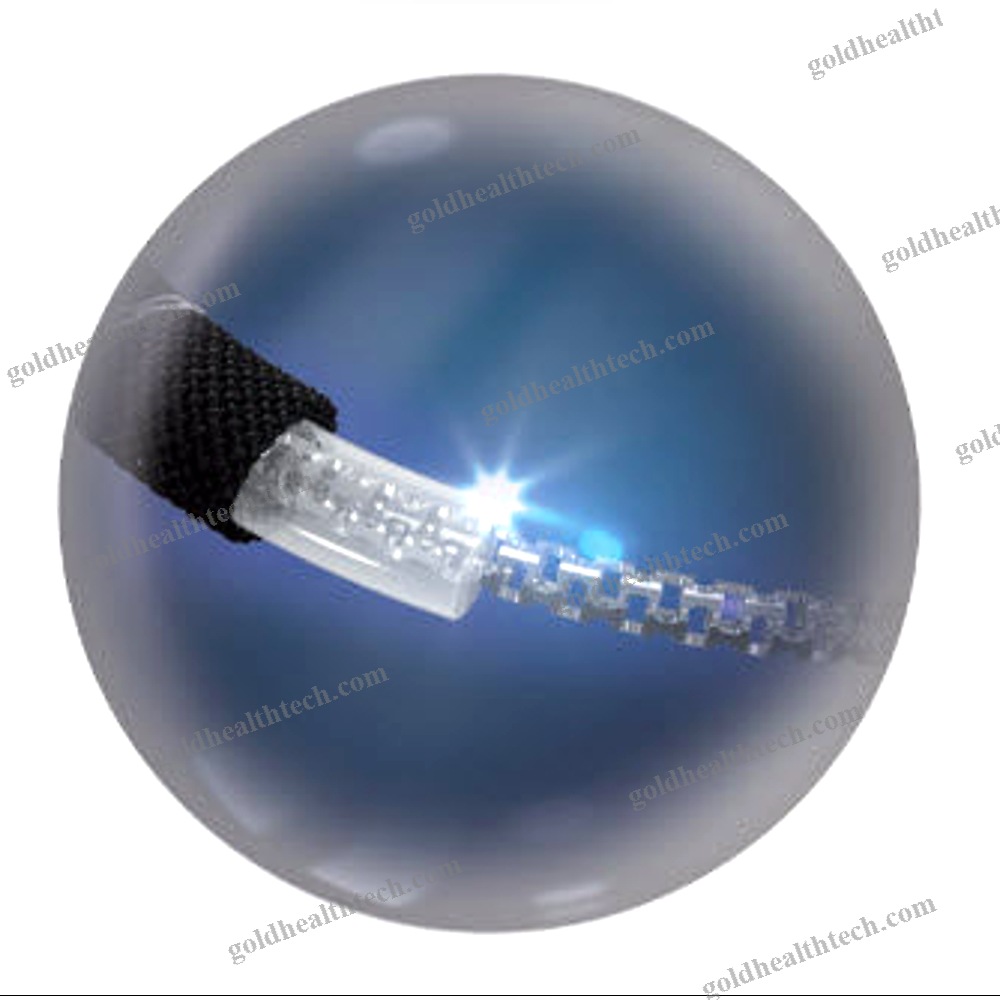 Mitral Annuloplasty Ring