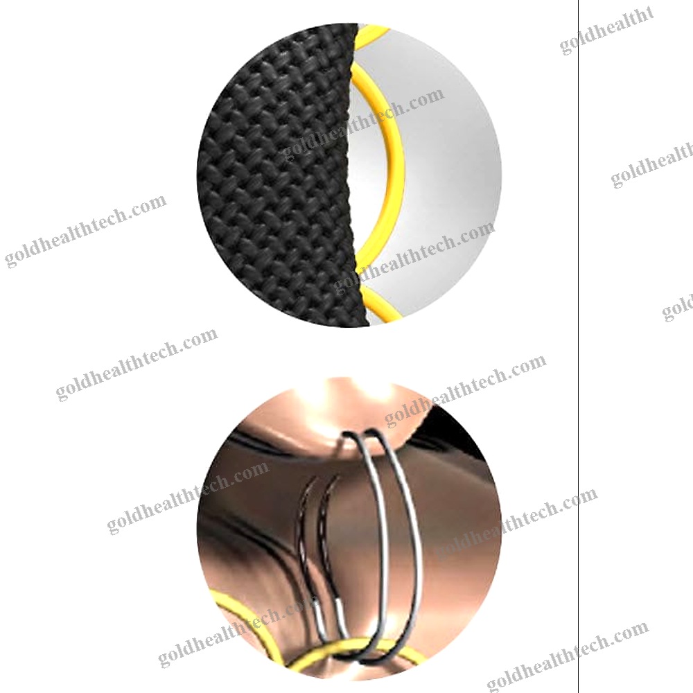 Mitral Annuloplasty Ring