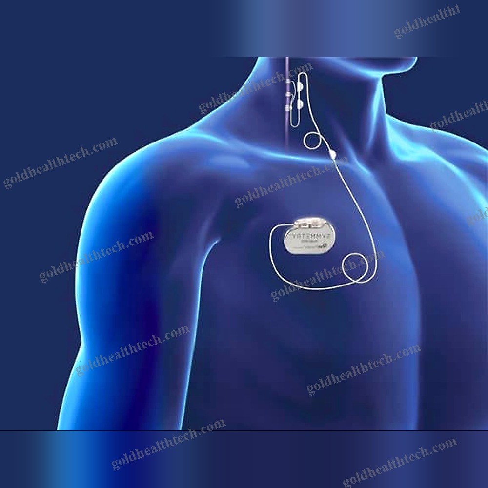 Implantable Neurostimulator