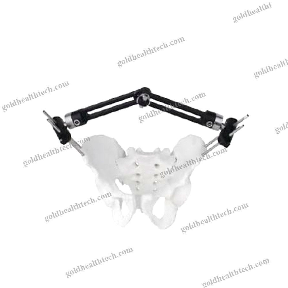 Pelvis External Fixation System