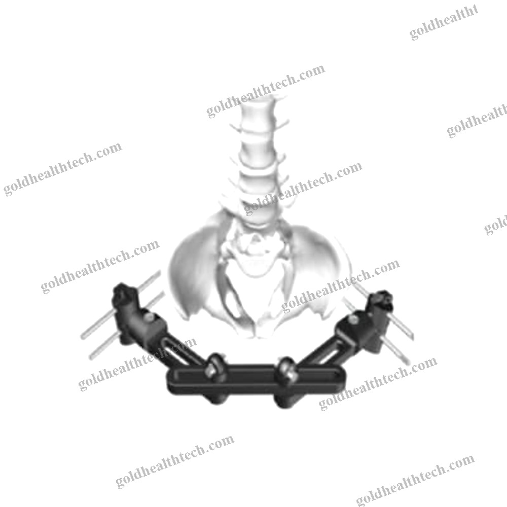 Pelvis External Fixation System