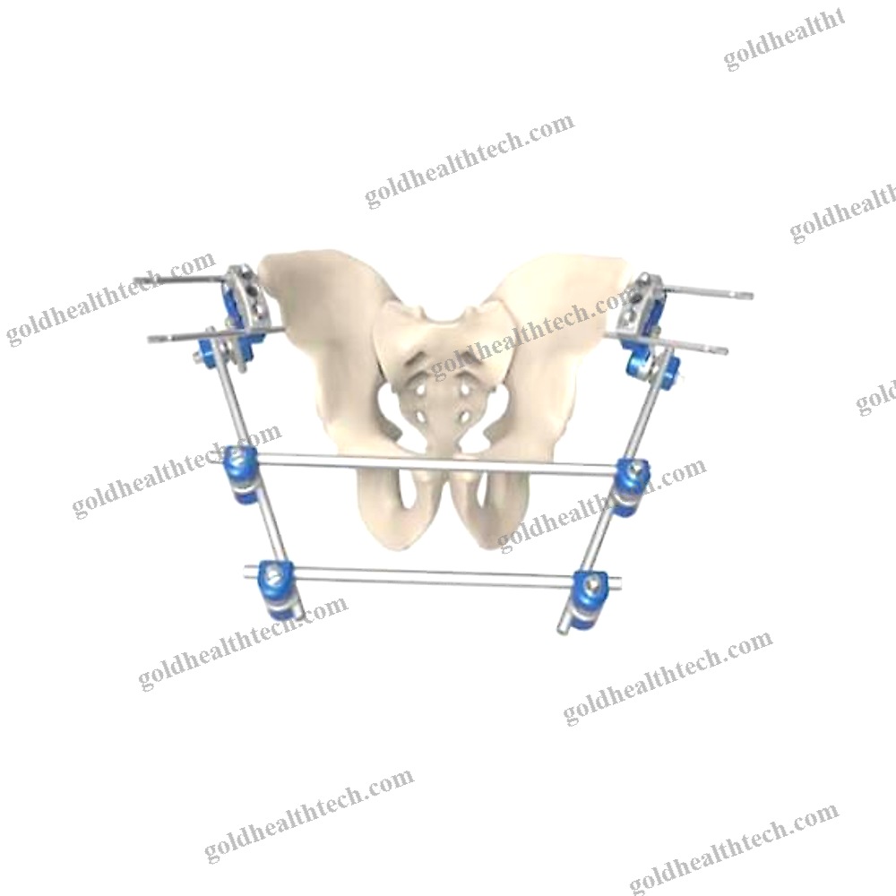 Pelvis External Fixation System