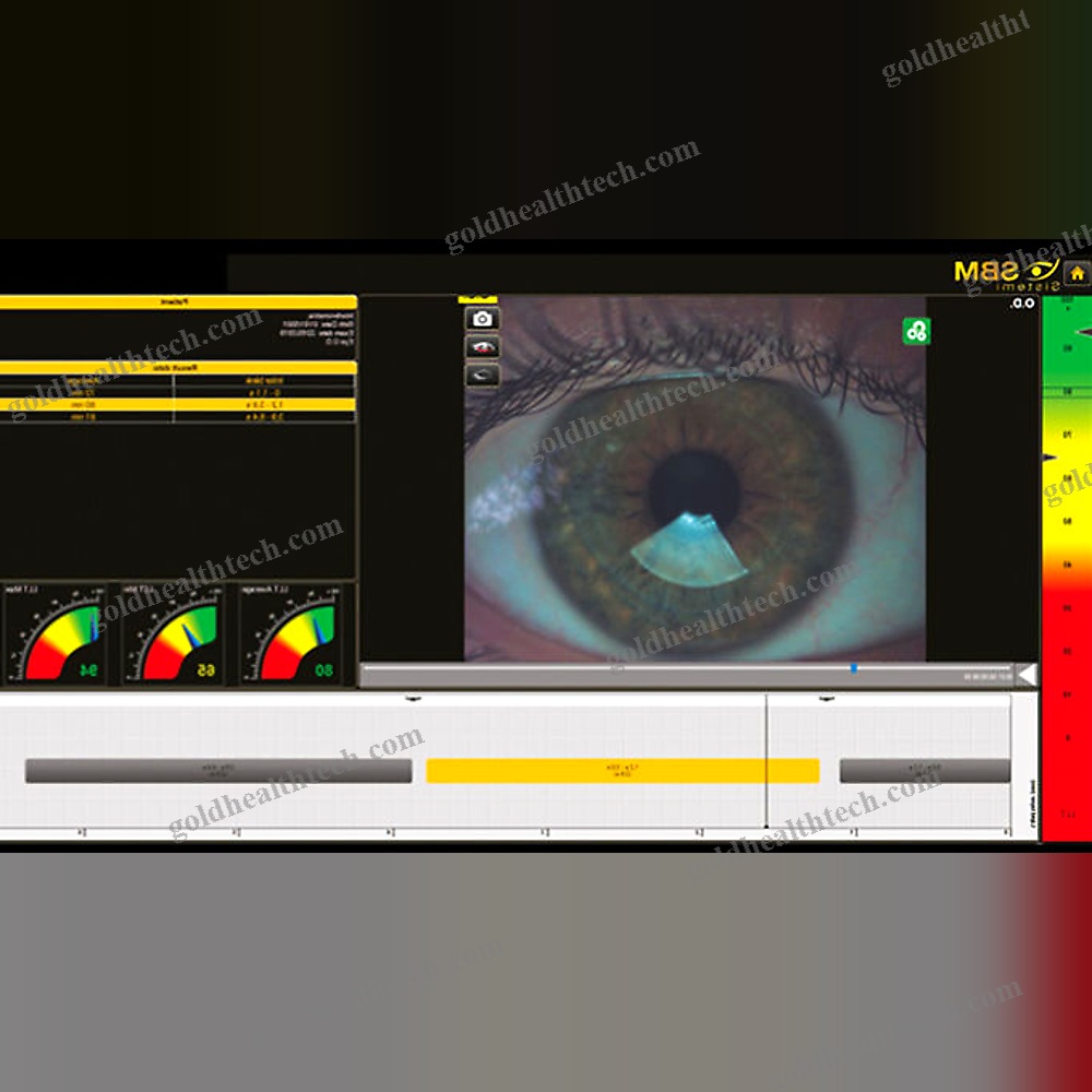 Meibography Dry Eye Diagnosis System