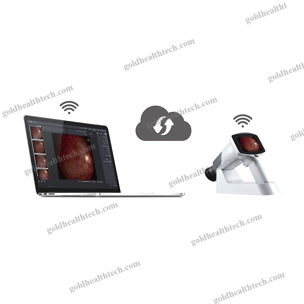 Non-Mydriatic Retinal Camera