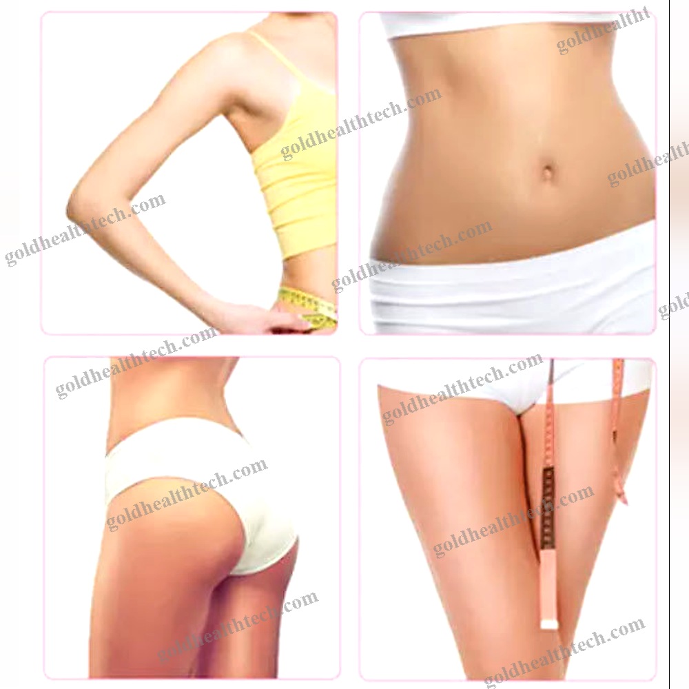 Dermatology Laser