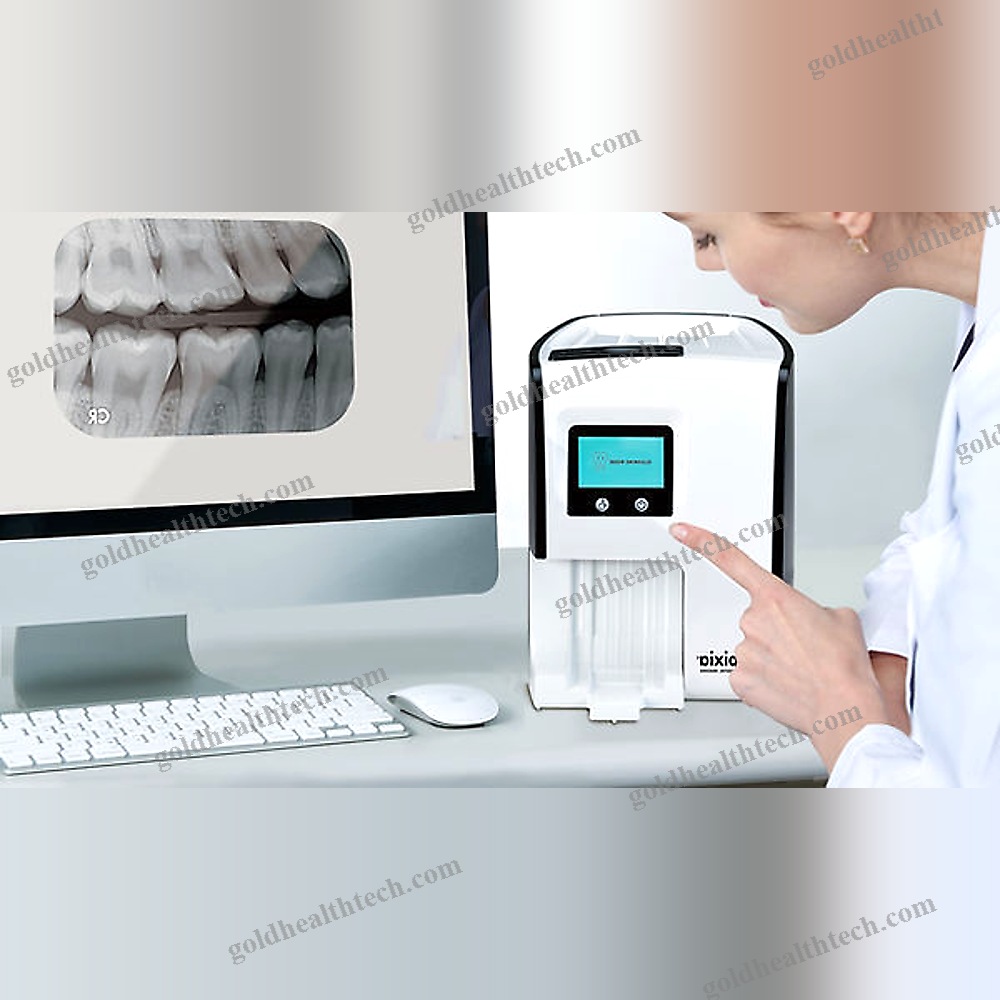 Intraoral Cr Scanner